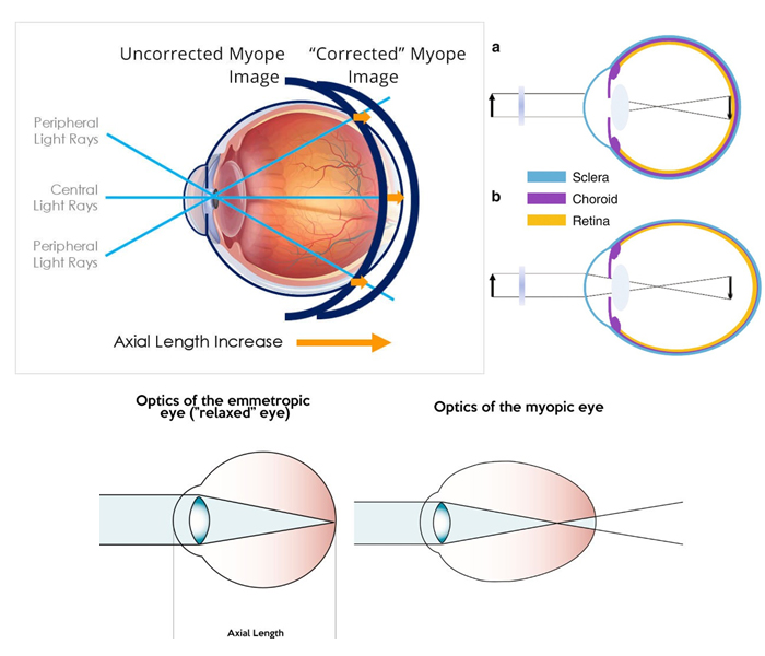 Corneo Eye Wear